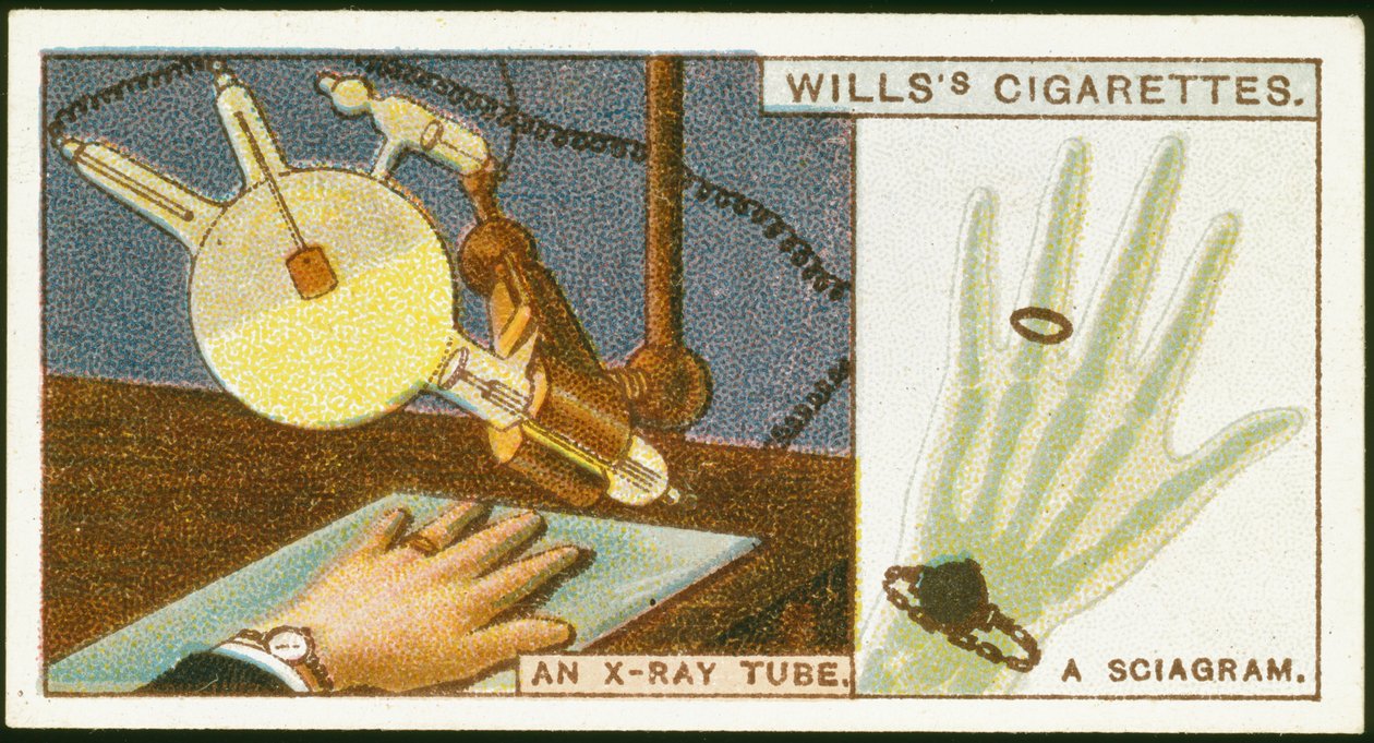 X-raying the hand, 1924 by Unbekannt