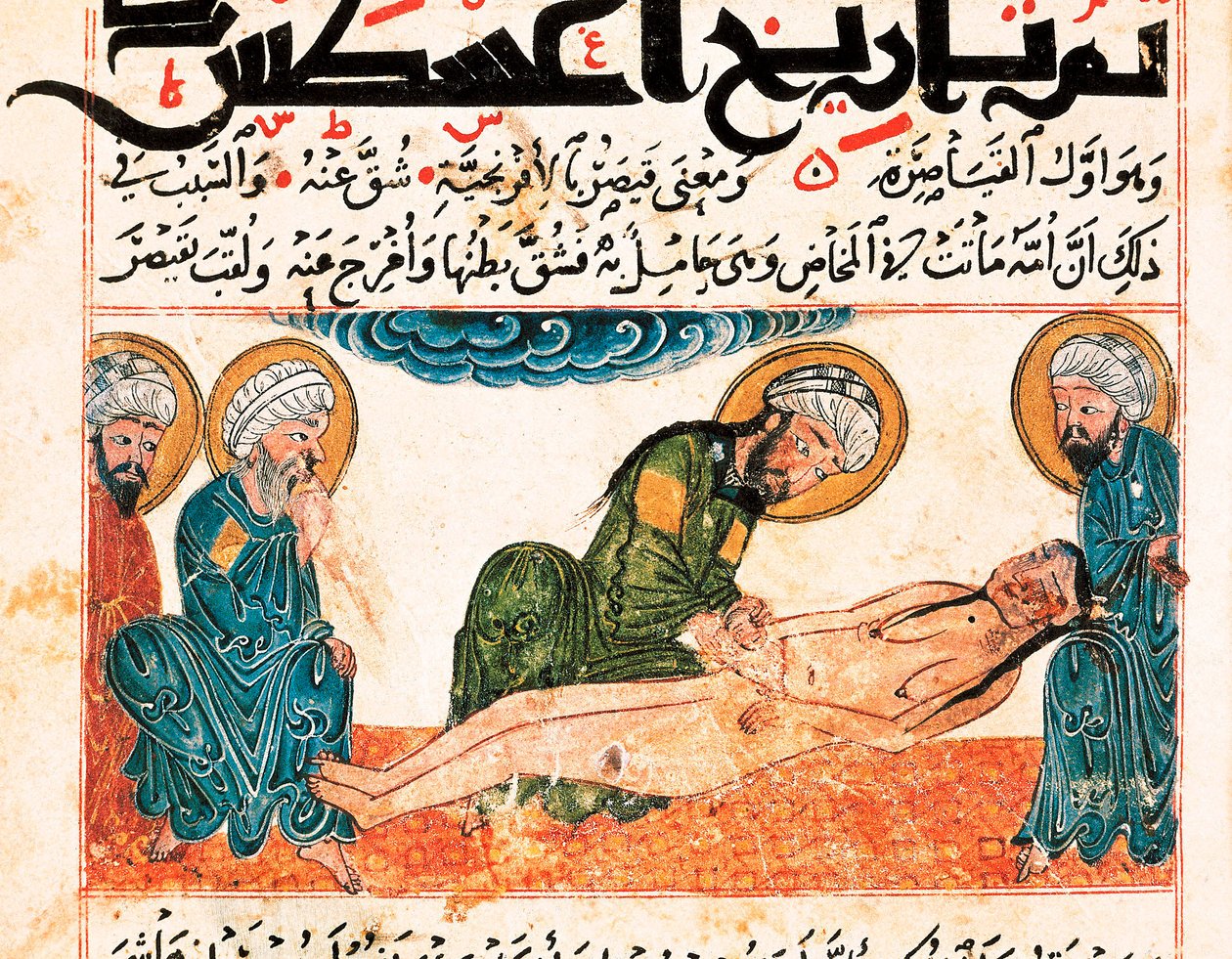 Representation of Cesarean Delivery. Miniature Taken from a Manuscript of Medicine by Abu Raihan Al-Biruni (or Alberuni) (973-1048), Persian Intellectual and Scientist, Folio 161 by Unbekannt