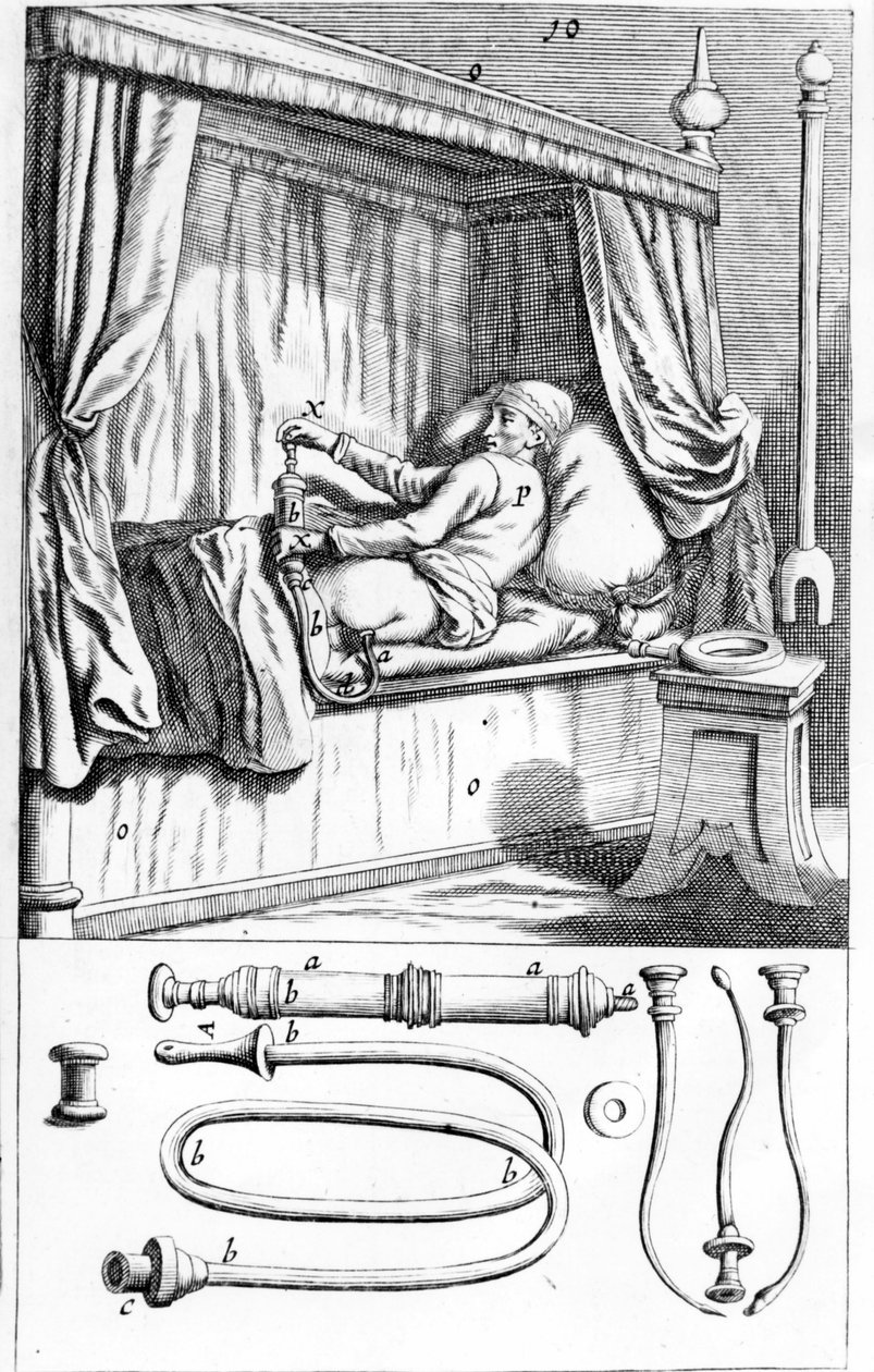 Clystère (for enemas) by Johannes Sculptetus 