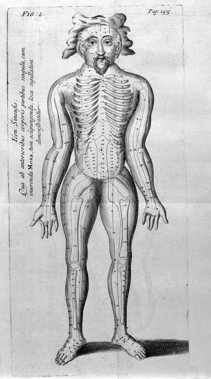 De Acupunctura by W.Ten Rhijne. London 1683. First Western text dealing with Acupuncture. by Unknown artist