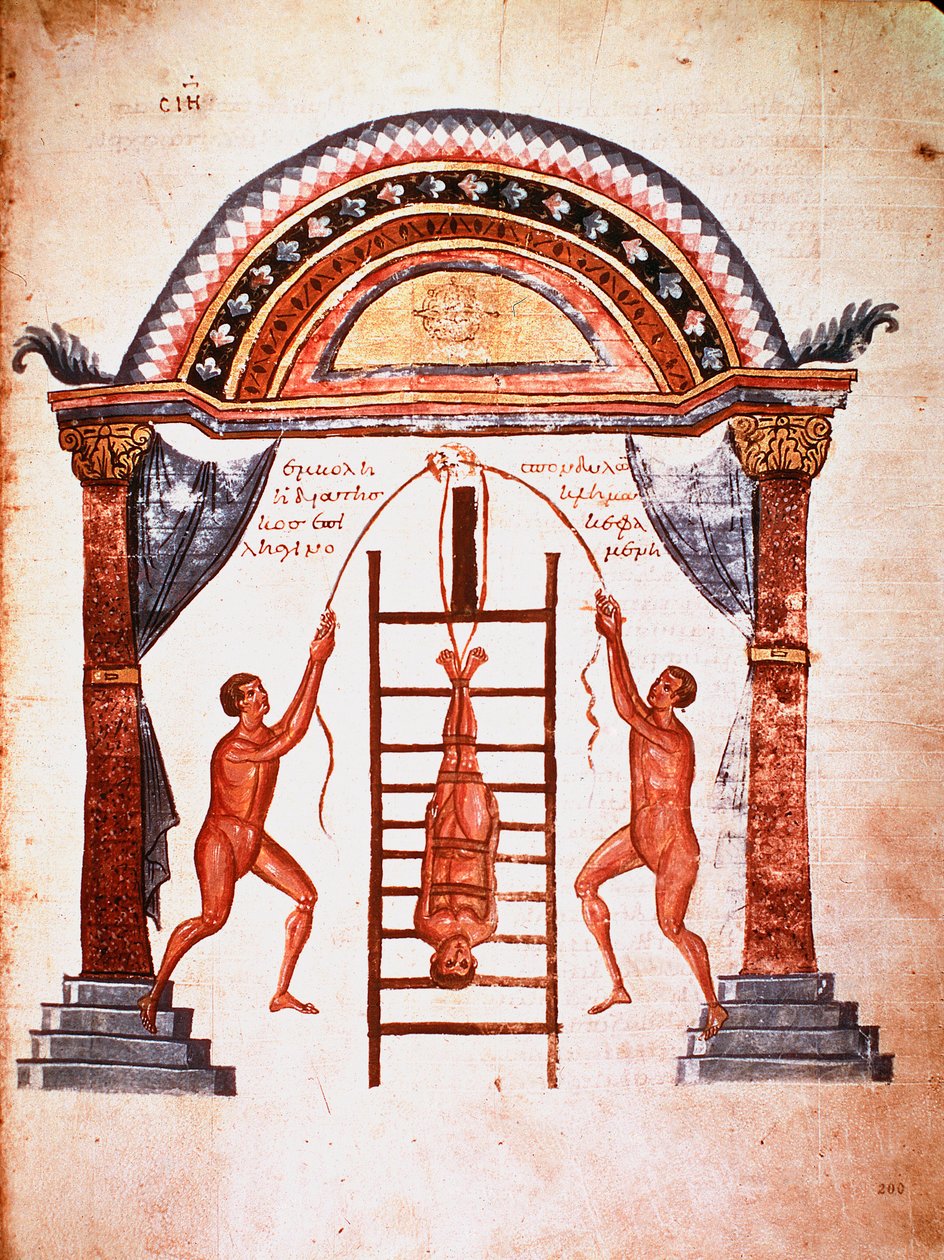Reduction of a Dislocated Spine by Unknown artist