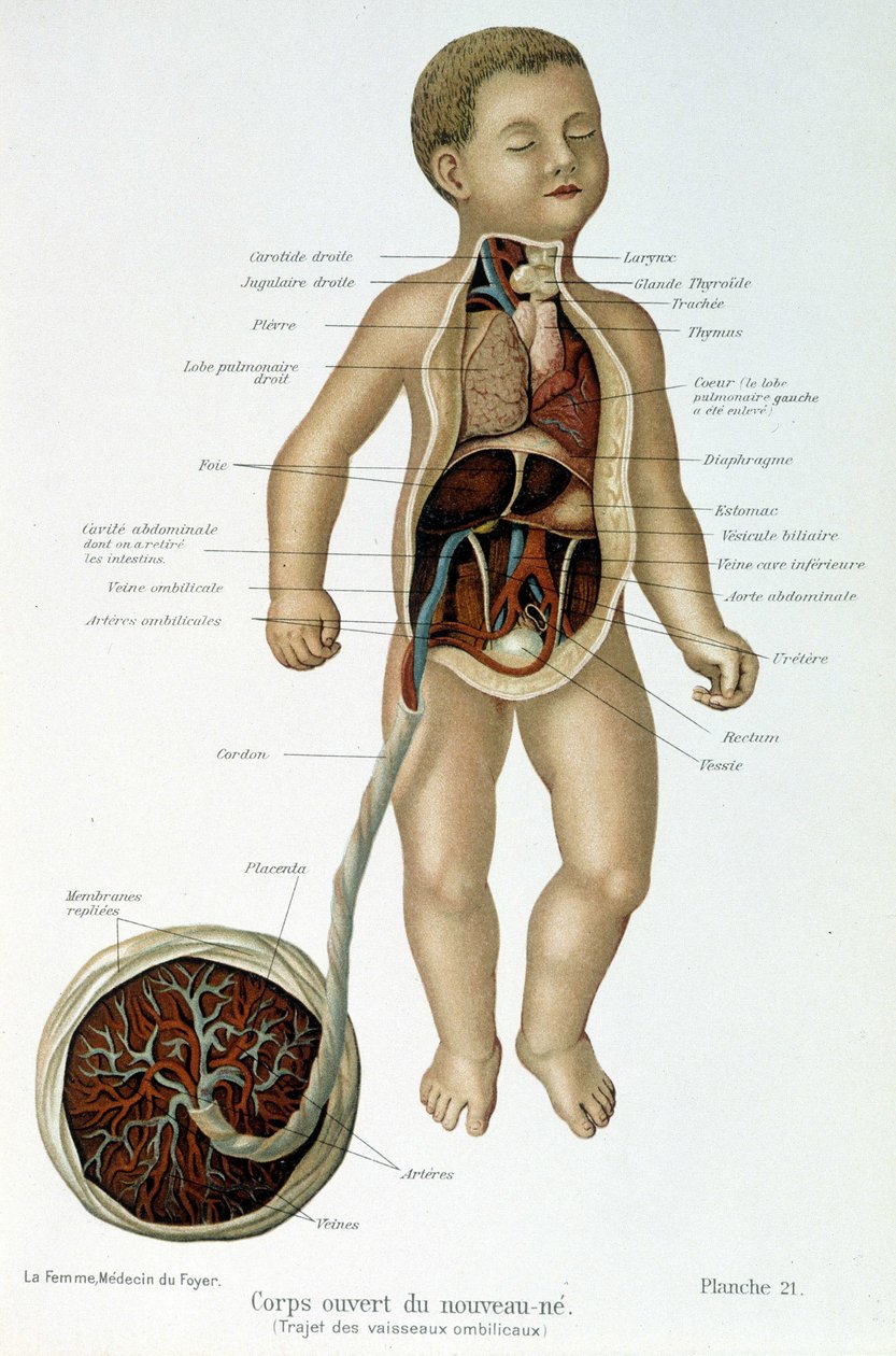 Medicine: Newborn (skinned in the bust) by Unknown artist