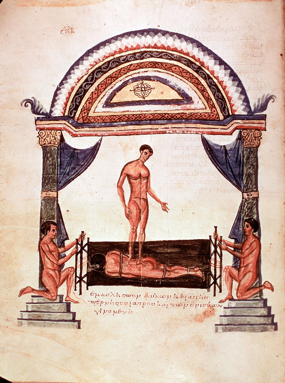 Medicine: Reduction of a Dislocated Spine - Patient is Fixed on a Wooden Board, One of the Therapists Stands on His Back by Unknown artist