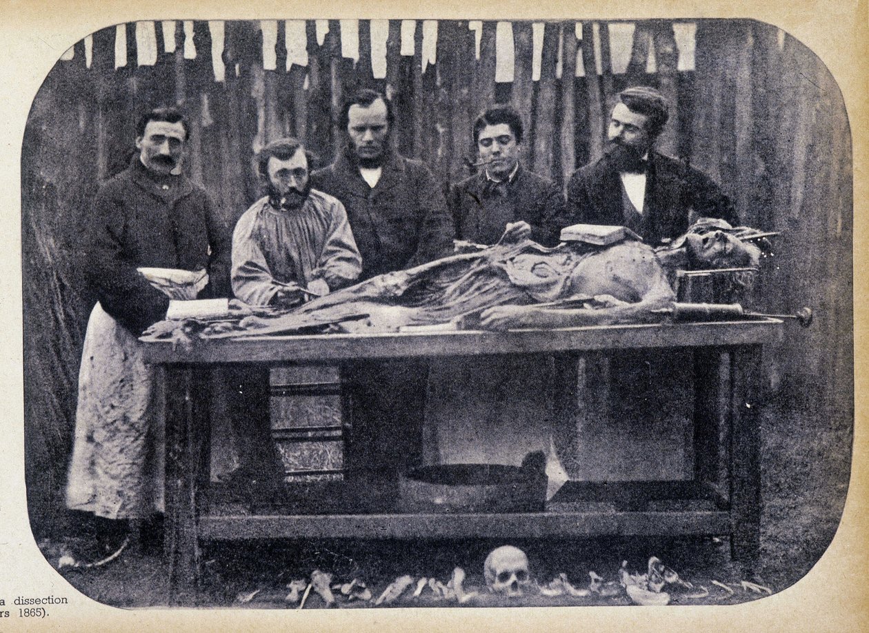 Dissection, c.1865 by Unknown photographer