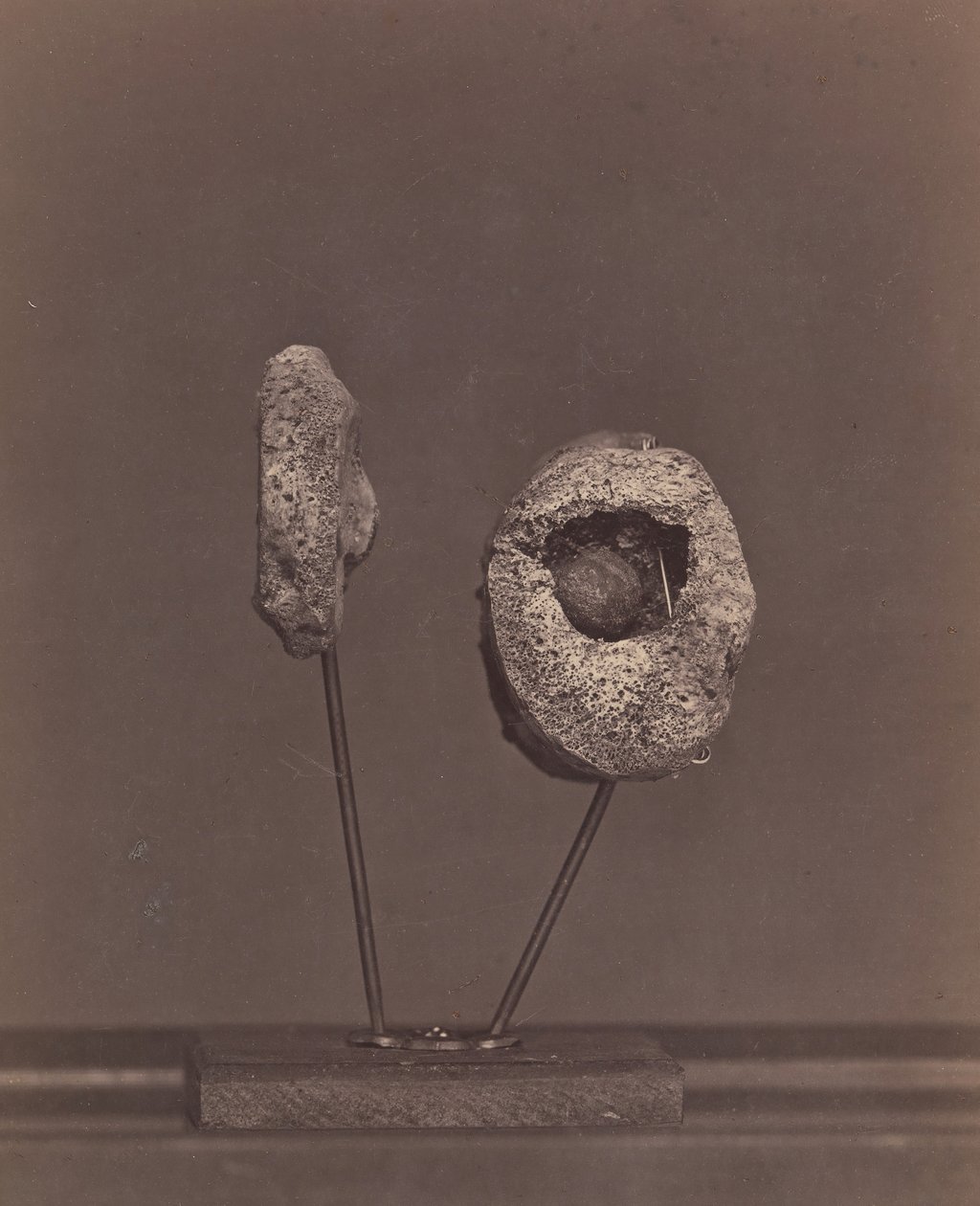 Excised Knee Joint. A Round Musket Ball in the Inner Condyle of the Right Femur by William H. Bell