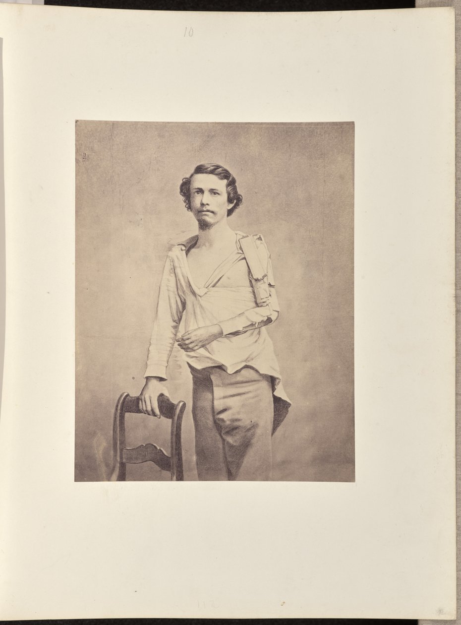 Successful Excision of the Head of the Left Humerus by William H. Bell