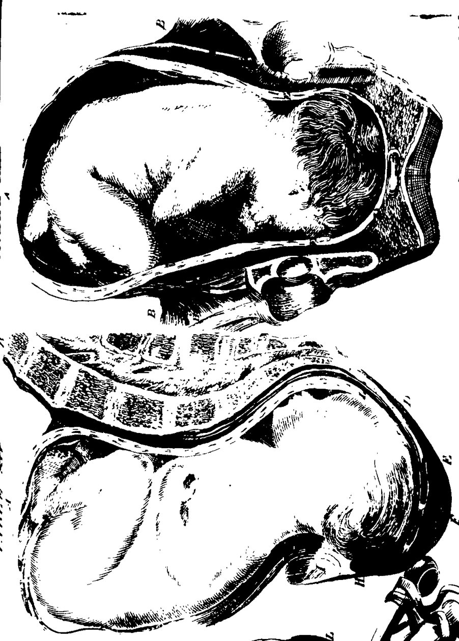 Fleuron from Book: A Treatise on the Theory and Practice of Midwifery by William Smellie