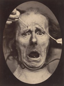 Electro-Physiologie, Figure 64