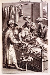 Illustration of moxibustion from Medicina Aegyptorum by Prospero Alpinus, 1745 by American School