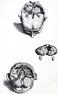 The Plates from the Seventh Book of the De Humani Corporis Fabrica by Andreas Vesalius