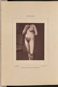 Generalized Vesicular Syphilis by Arthur de Montmeja