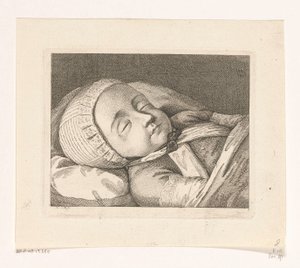 Child on Deathbed