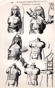 Operating on breast cancer, from Armamentarii Chirurgici by Johannes Schultes published in Amsterdam, 1672 by Dutch School