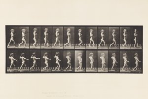 Bow Legs; Boy; Spinal Caries; Girl Walking