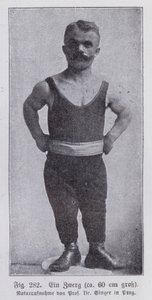 Dwarfism: 60 cm tall man from Prague