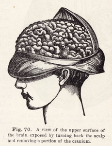 A view of the upper surface of the brain, exposed by turning back the scalp and removing a portion of the cranium by English School