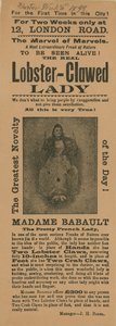 Advert for an Appearance of Madame Babault, the Lobster-Clawed Lady by English School