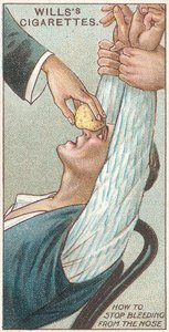 How to Stop Bleeding from the Nose, no.31 from the First Aid series of Wills Cigarettes cards, 1913