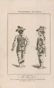 Side and Back View of the Hairy Girl