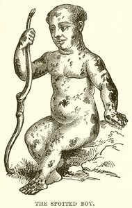 The Spotted Boy