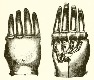 The Steel Hand of Carslogie by English School