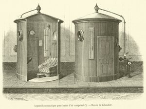 Pneumatic Apparatus for Compressed Air Baths (engraving)