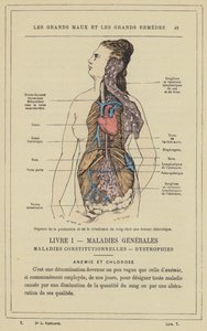 Organs of Blood Production and Circulation in a Chlorotic Woman by French School