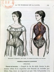 The Harmful Effects of the Corset, illustration from La Vie Normale et la Sante by Dr Jules Rengade (b.1841) c.1880 by French School
