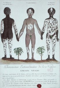 The Phenomenon of Leukoderma by French School