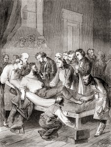 The First Public Demonstration of the Use of Inhaled Ether as a Surgical Anaesthetic in 1846 by William Thomas Green Morton by French School