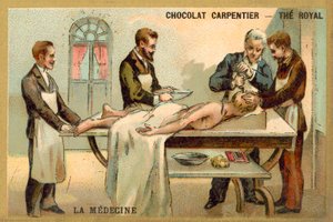 Trepanning by French School