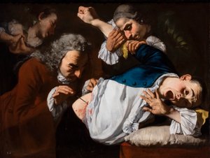 The Operation, circa 1753/54 by Gaspare Traversi