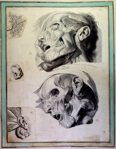 Debarked Human Heads: Muscles and Skeletons are Visible