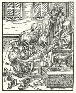 An Amputation by German School