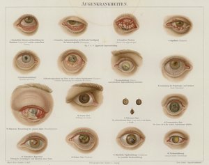 Eye disorders by German School