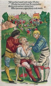 Removing an Arrow, Illustration from Feldtbuch der Wundartzney by Hans von Gersdorff by German School
