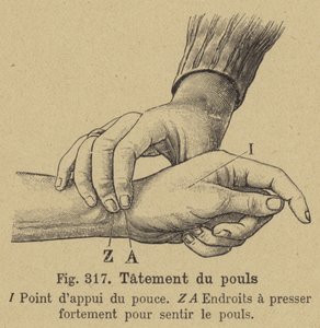 Taking the Pulse at the Wrist