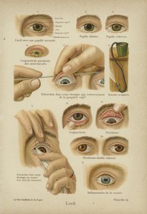 The Eye by German School
