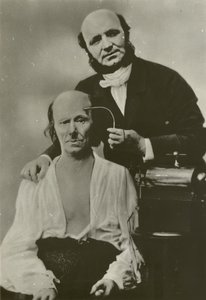 French neurologist Duchenne de Boulogne using his electrophysiology apparatus on an old man