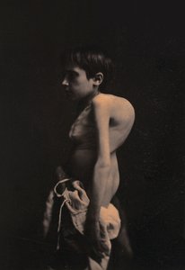 Portrait of a hunchback boy by Guillaume Benjamin Armand Duchenne de Boulogne