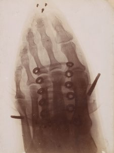 The Foot Through the Shoe