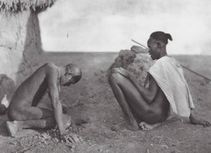Africa: Medicine-man bleeding a patient by Hugo Adolf Bernatzik