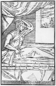 Reconstructive surgery on the nose, illustration from De curtorum chirurgia per insitionem by Gaspare Tagliacozzi, Venice, published 1597 by Italian School