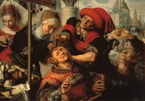 The Surgeon by Jan Sanders van Hemessen