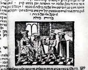 Circumcision