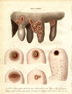 Inoculation and Disease Progression by John Pass