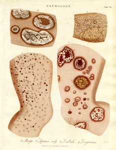 Pathological Skin Conditions: Schurigie, Leprous Skin, Pallada and Impetigo by John Pass