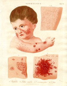 Pathological Skin Diseases by John Pass