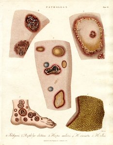 Various Skin Eruptions and Ulcers by John Pass