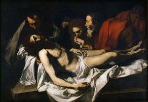 The Deposition